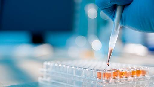 AlphaLISA-Surefire-Ultra-Immunoassay-Platform-Guide.jpg