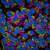 HepG2 cells stained with PhenoVue Multi Organelle Staining Kit after oleic acid treatment, imaged on the Opera Phenix Plus HCS system.